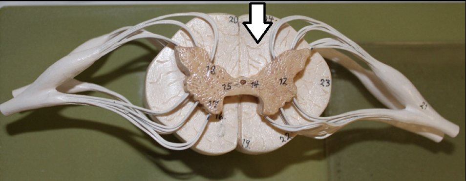 <p>identify this specific area</p>