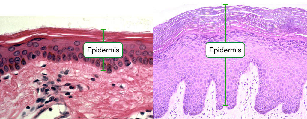 <ul><li><p>outermost tissue layer of the skin</p></li><li><p>composed primarily of keratinocytes arranged into layers called strata</p></li><li><p>image shows the difference between thin and thick skin</p><ul><li><p>thin skin epidermis has 4 strata layers</p></li><li><p>thick skin epidermis has 5 strata layers (palms and soles)</p></li></ul></li></ul><p></p>