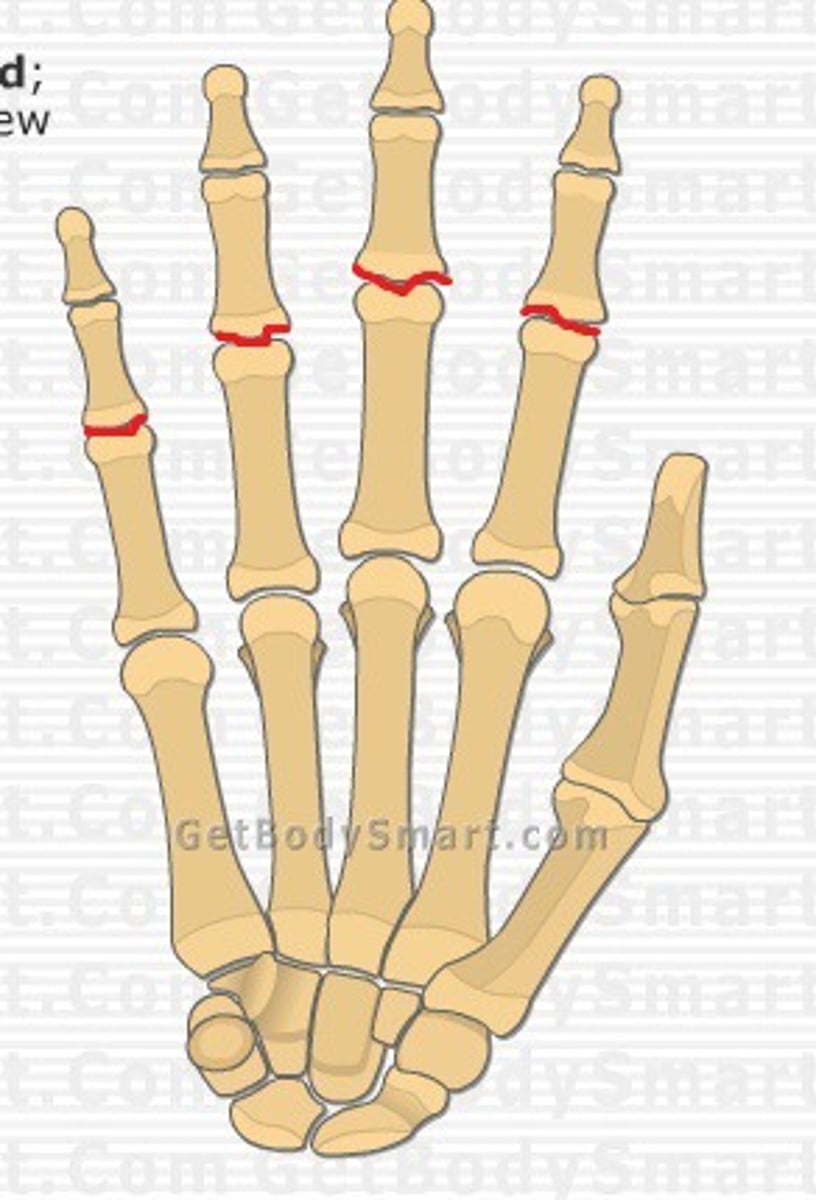 <p>- articulation of the proximal phalanges with the middle phalanges</p><p>- hinge type of synovial joint</p><p>- permits flexion/extension of the digits</p><p>- only present in digits 2-5</p>