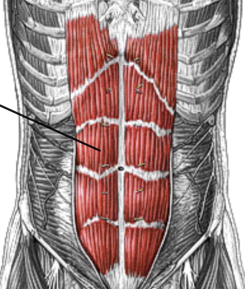 <p>Which muscle of the abdomen is:</p><ul><li><p>The abs, six packs</p></li><li><p>Action: flex spine</p></li><li><p>Nerve: <span style="color: yellow;">T7-T12</span> nerve roots</p></li></ul><p></p>