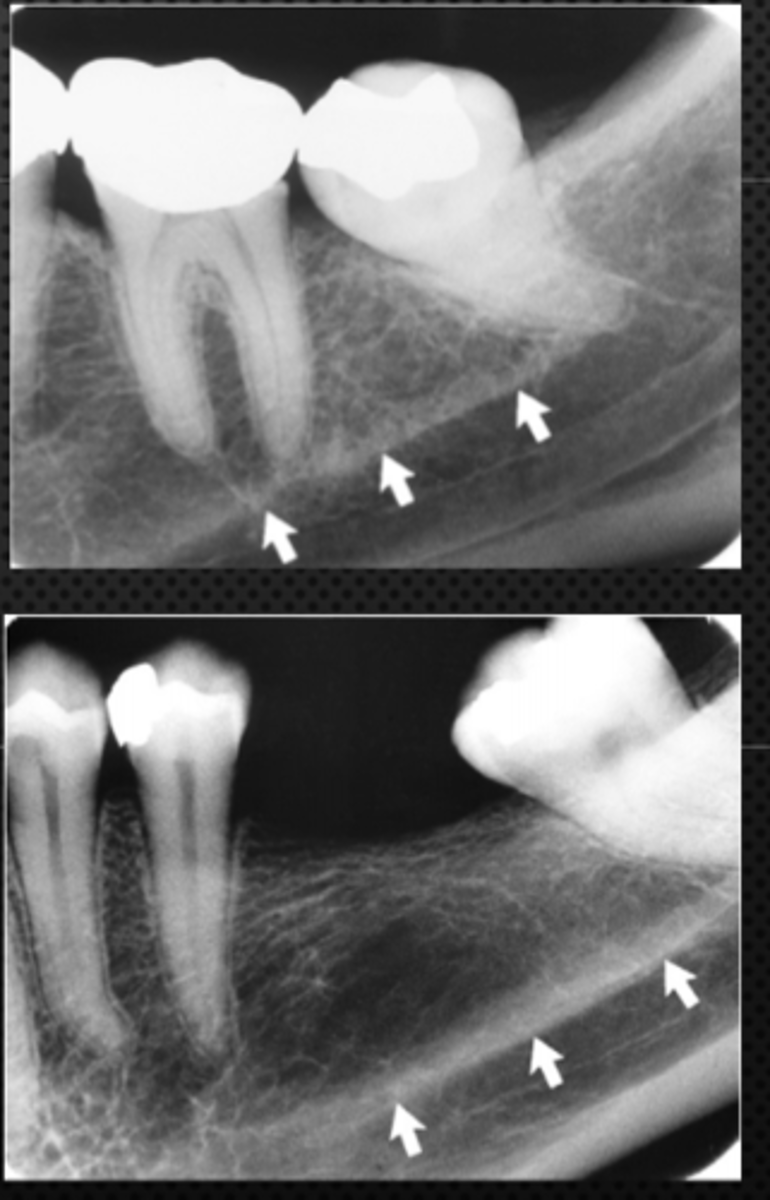 <p>Identify the radiopaque structure</p>