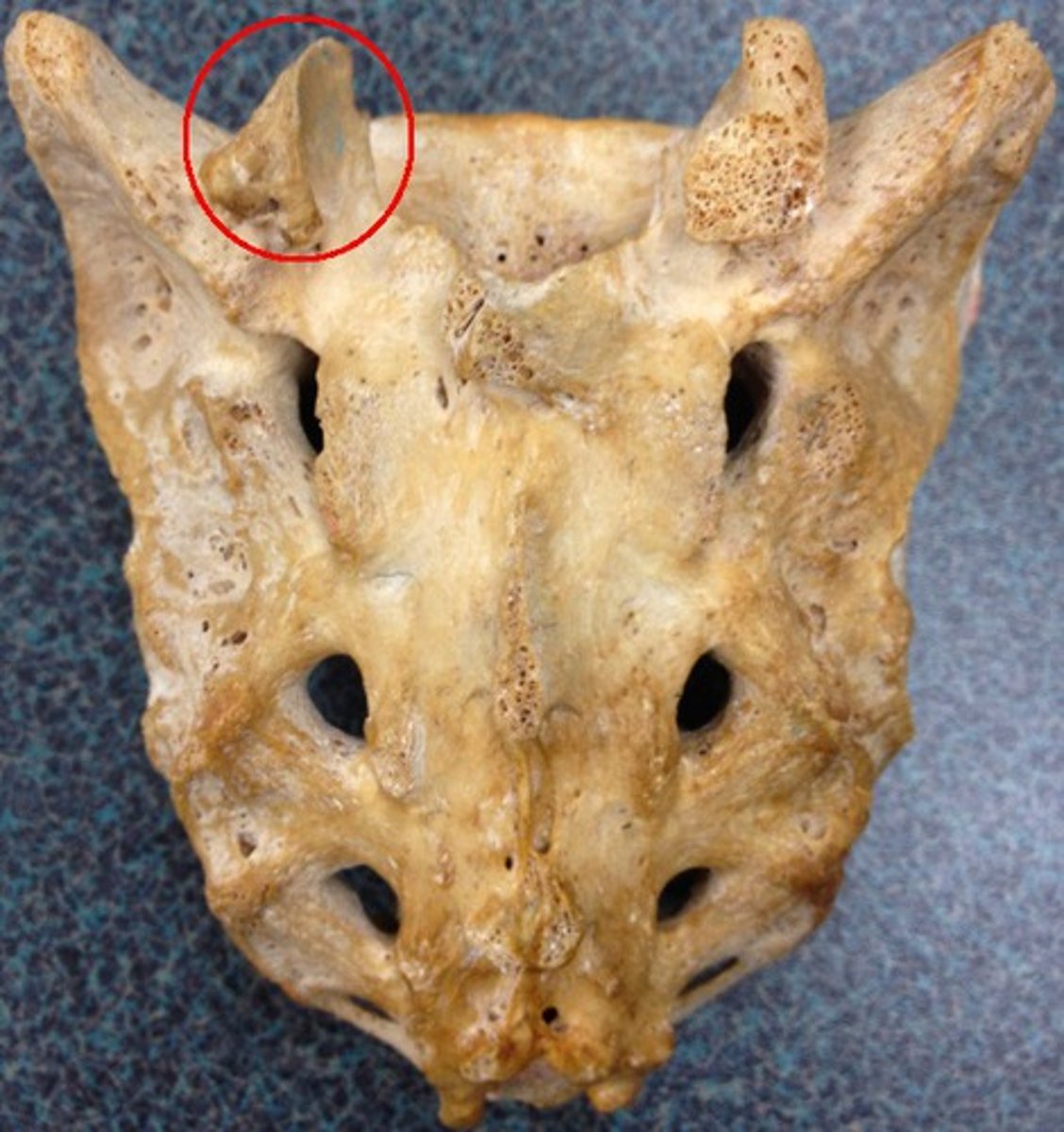 <p>where smooth surface is on process</p>