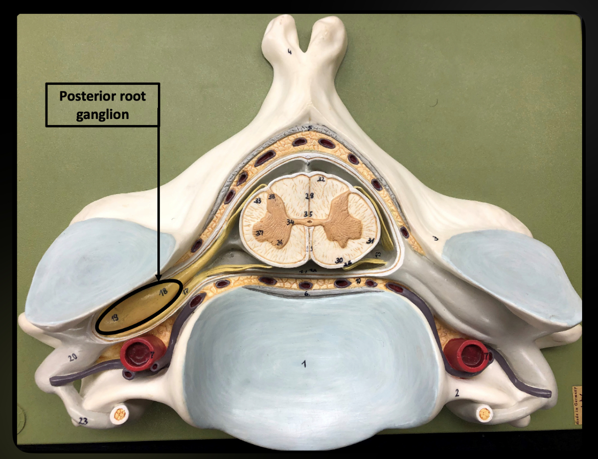 <p>Posterior Root Ganglion</p>