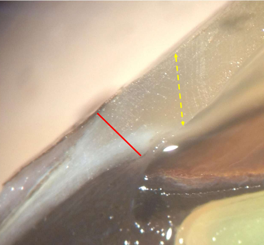 <ul><li><p>transitional area of 1-2 mm in width where conrea merges with sclera</p></li><li><p>appears as a blue-grey ring</p></li><li><p>anterior margin of limbus corresponds to peripheral termination of descmet’s membrane (Schwables line)</p></li><li><p>posterior margin where coloration gives way to white sclera responds to posterior limit of Schlemm’s canal at the scleral spur</p></li></ul><p></p>