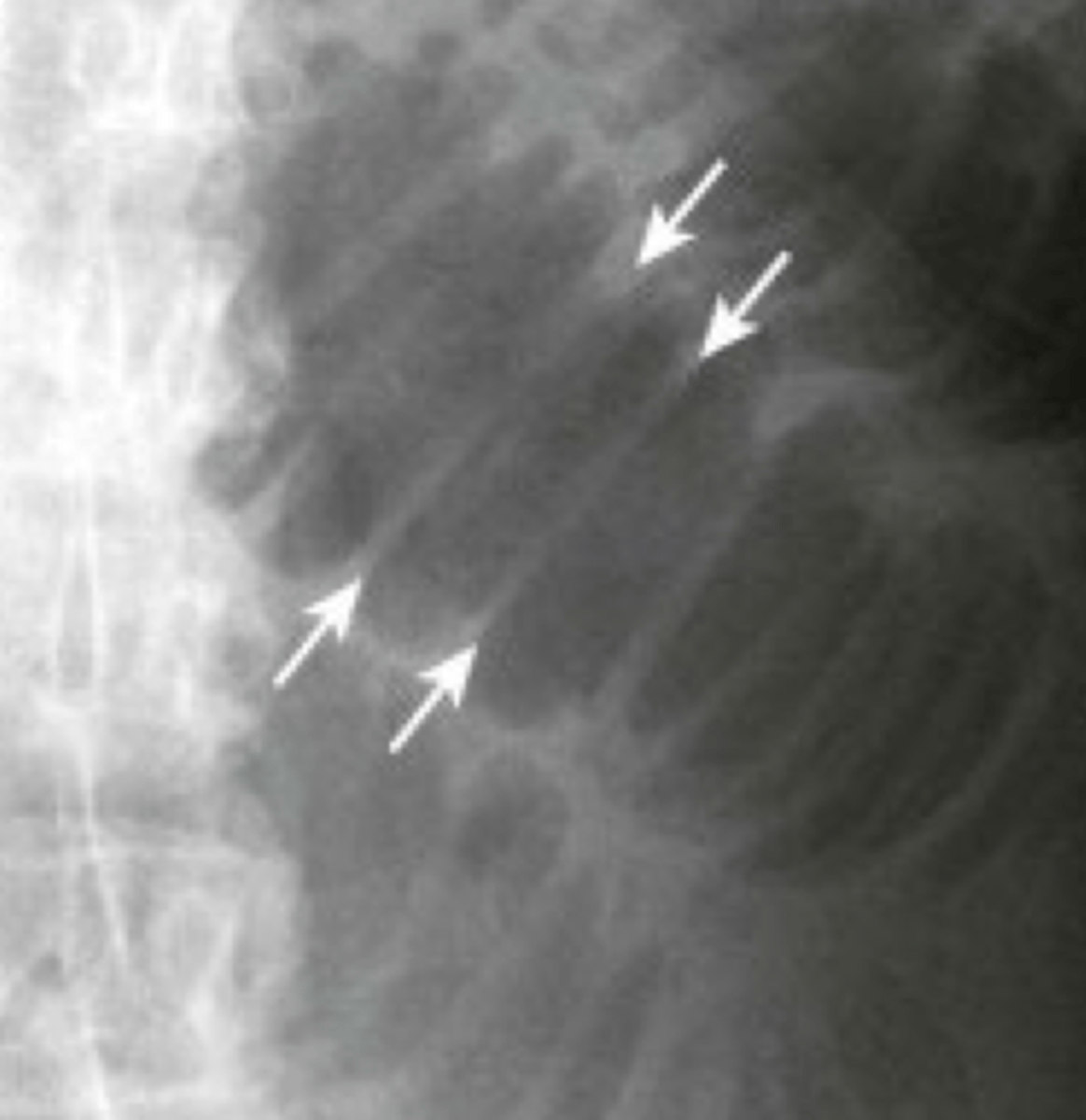 <p>this is a cross section of what</p>