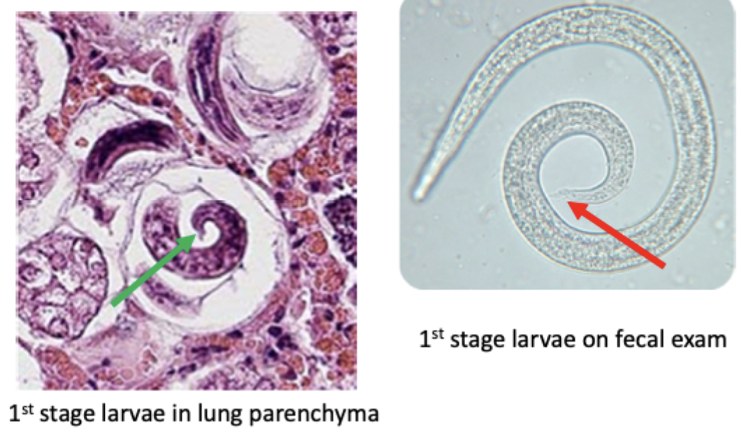 <p>Which first stage larvae is shown in the image? How do you know?</p>