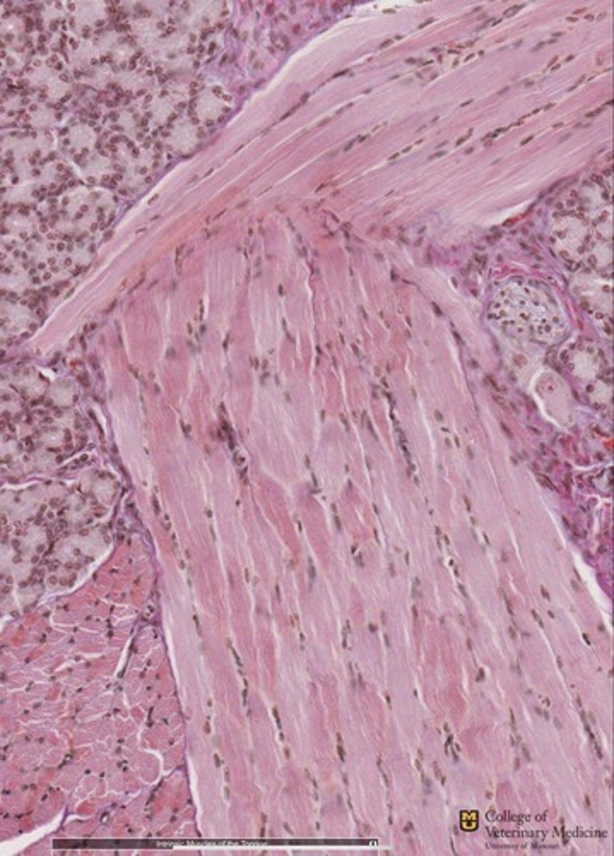<p>What tissue type is shown?</p>