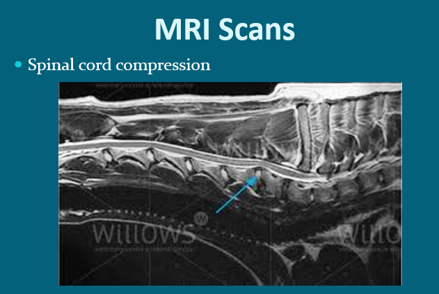 <p>Use of contrast media&nbsp;</p>