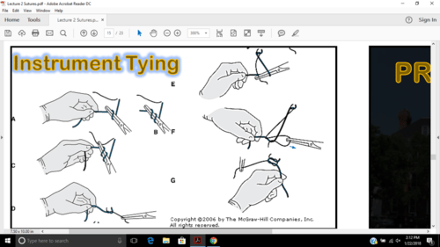 <p>Needle Driver Technique</p><p>Most common method for skin closure and minor procedures</p><p>Efficient and Precise</p>