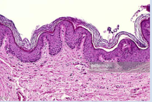 <p>What are orthokeratinized cells?</p>