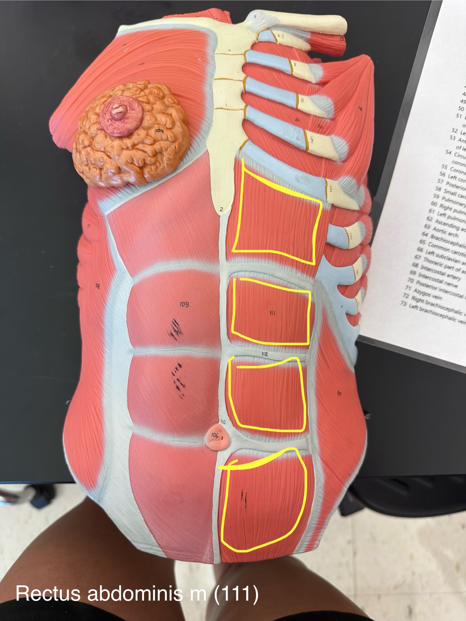 <p>Rectus abdominis muscle</p>