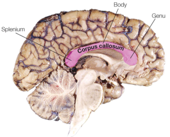 <p>• anterior part: genu </p>
<p>• middle part: body </p>
<p>• posterior part: splenium</p>