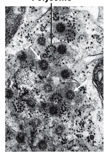 <p>the line indicates what in the cell?</p>