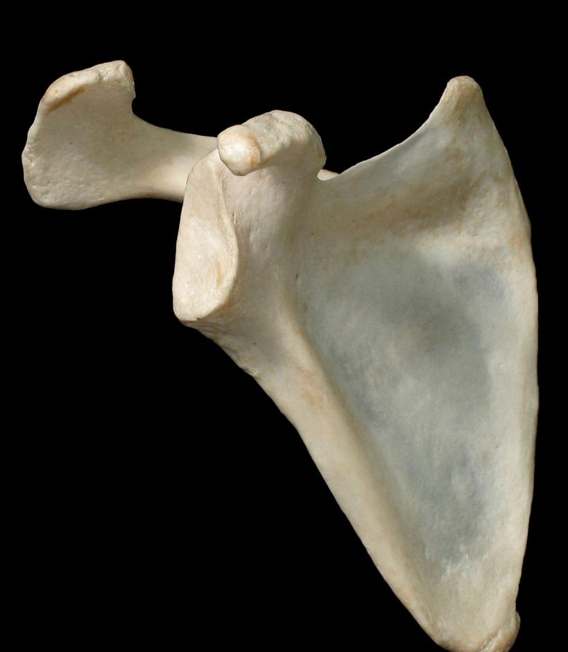 <p>Is this the anterior or posterior aspect of the scapula?</p>