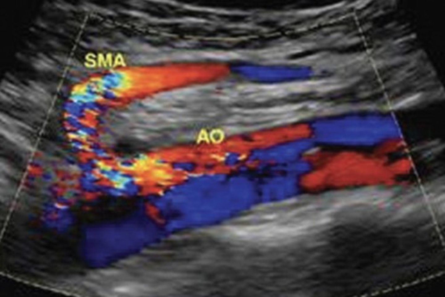 <p>Separation of channels - flap line</p><p>To and fro flow</p>