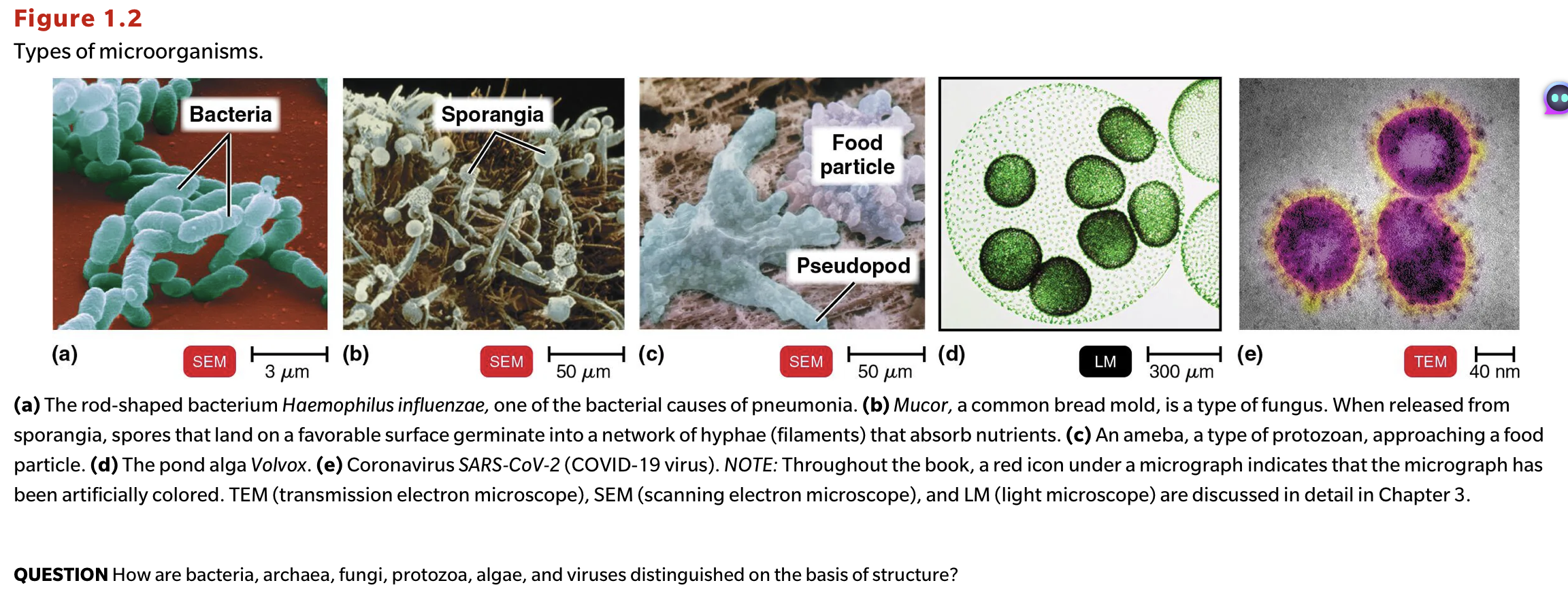 <p>QUESTION How are bacteria, archaea, fungi, protozoa, algae, and viruses distinguished on the basis of structure?</p>