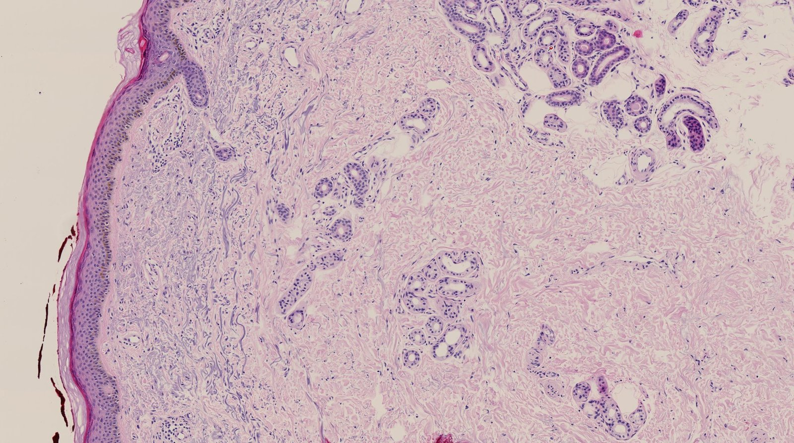 <p>C. It is a typical component of thin (hairy) skin.</p>