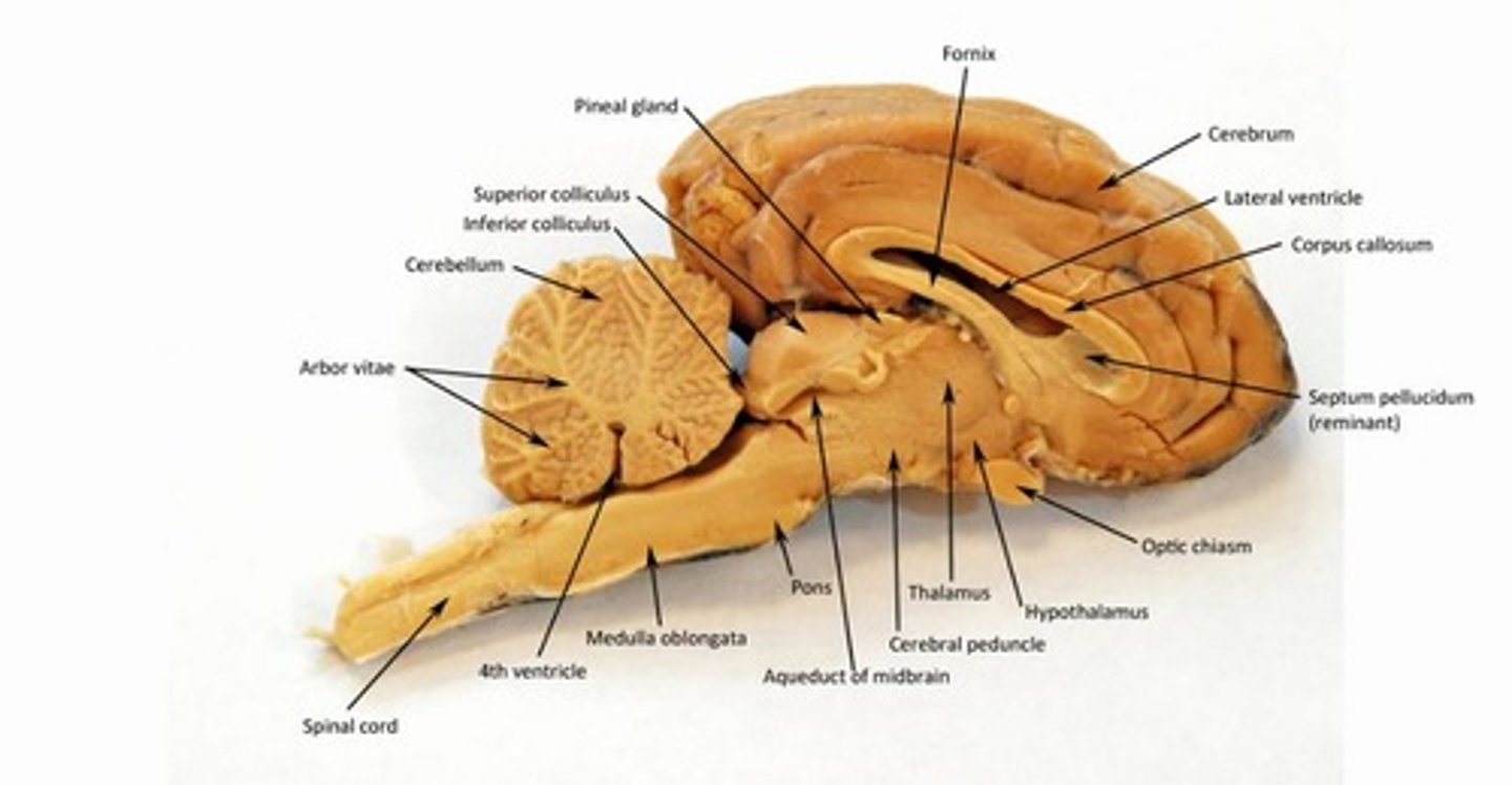 <p>large band of white matter forming roof of lateral ventricles; connects the two cerebral hemispheres</p>