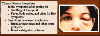 <p>Chagas disease.</p>