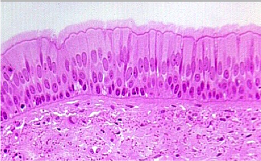 <p>pseudostratified ciliated columnar ET </p>