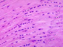 fibrocartilage