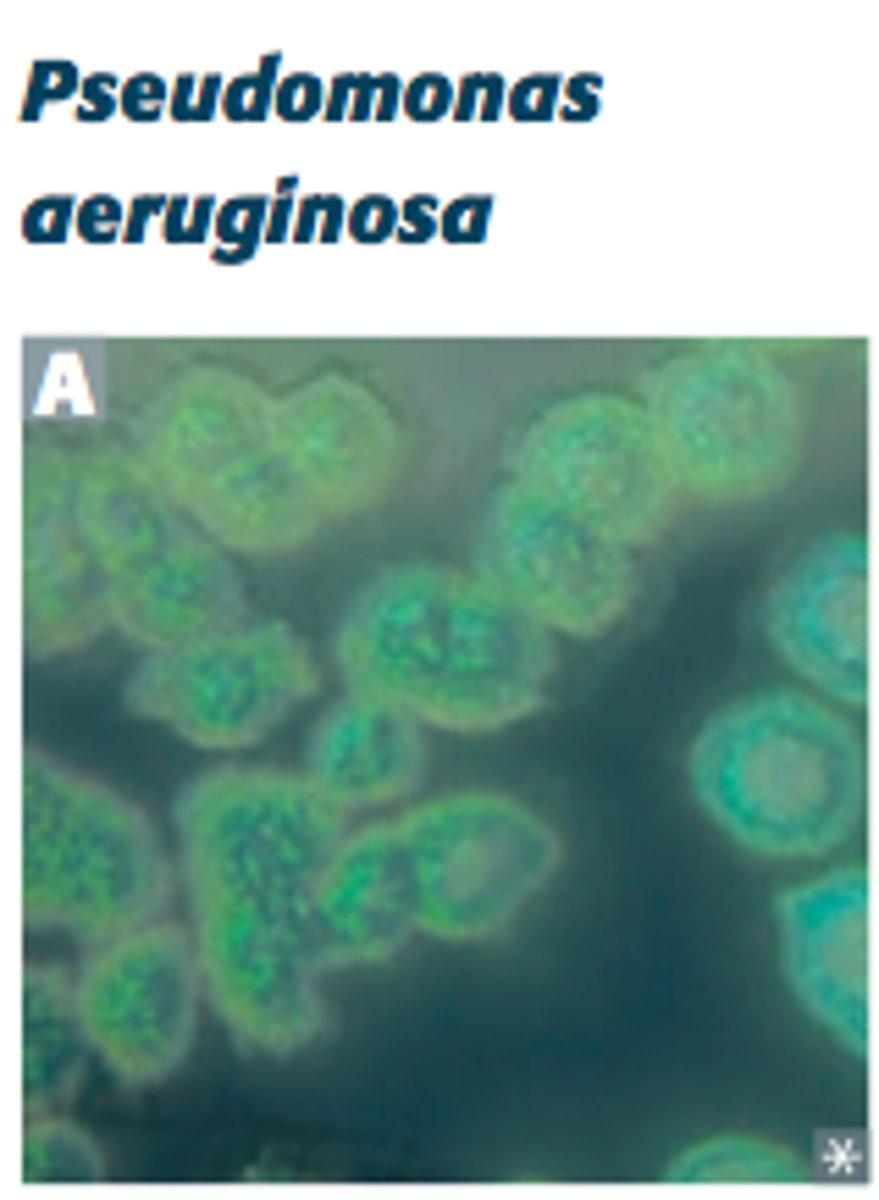 <p>Pseudomonas aeruginosa</p>