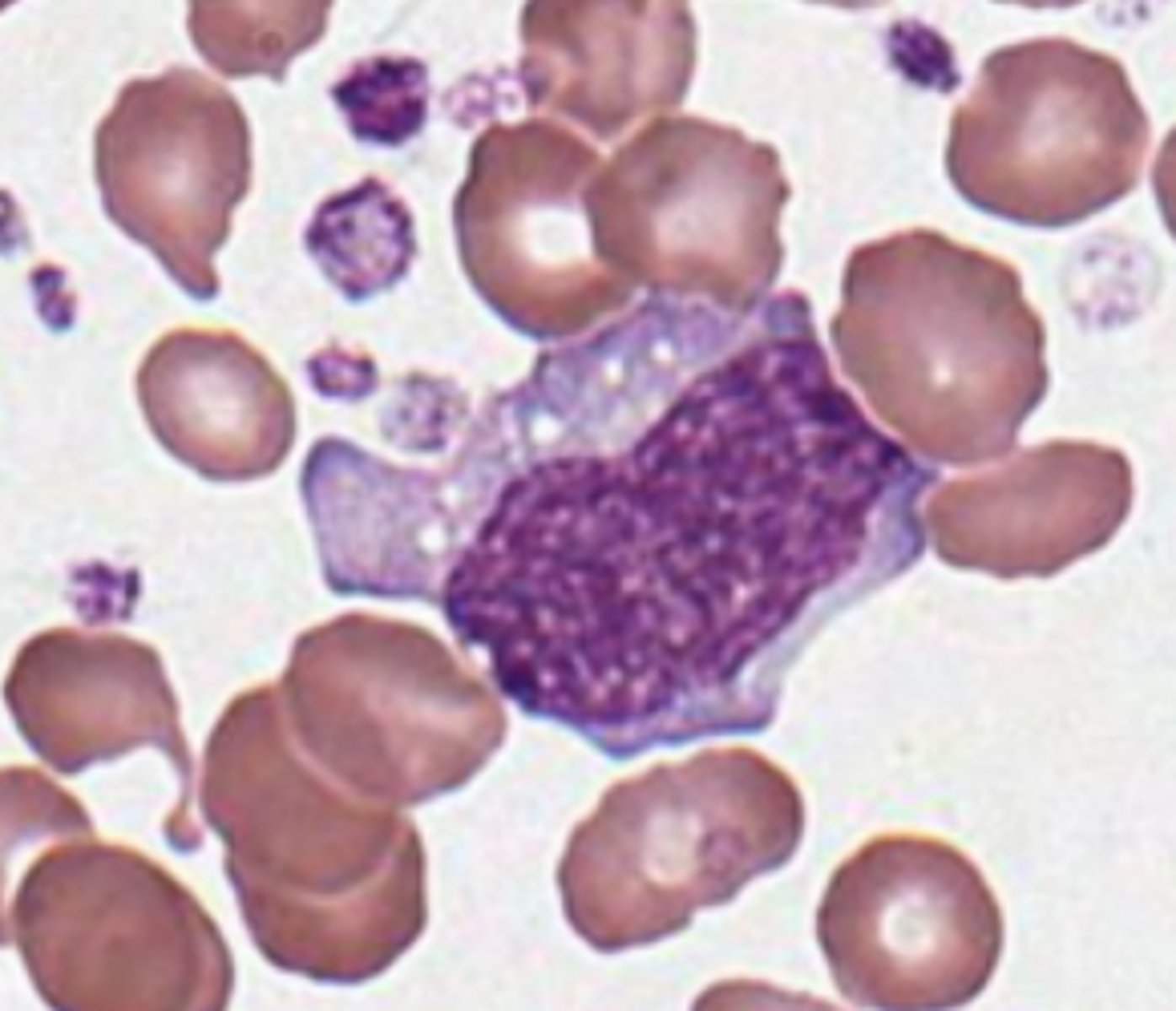 <p>- SIZE! in comp to other cells</p><p>- HAVE to see abnormal plt morphologies</p><p>- blebs + perinuclear blue granules</p>