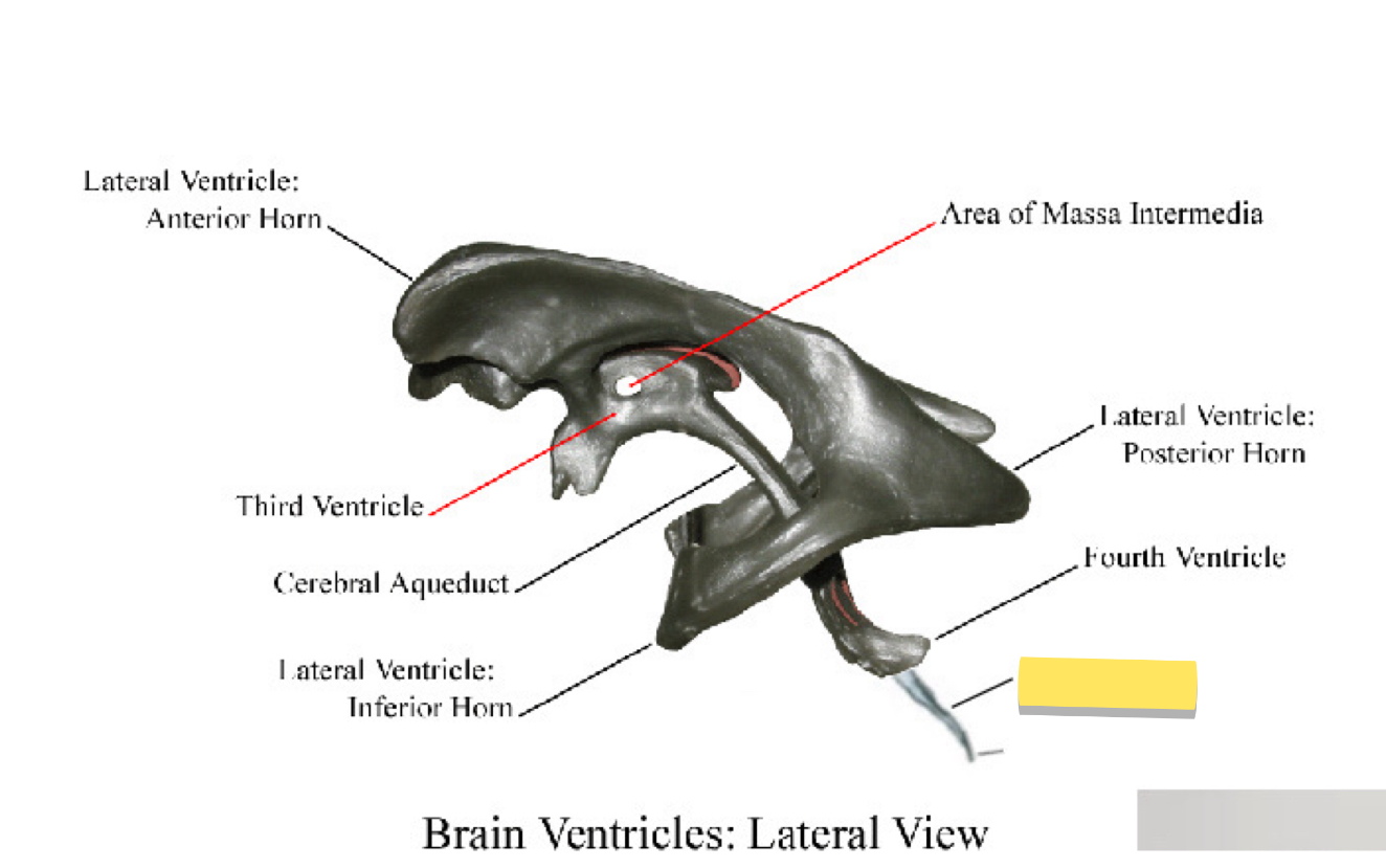 <p>Name this brain ventricle </p>