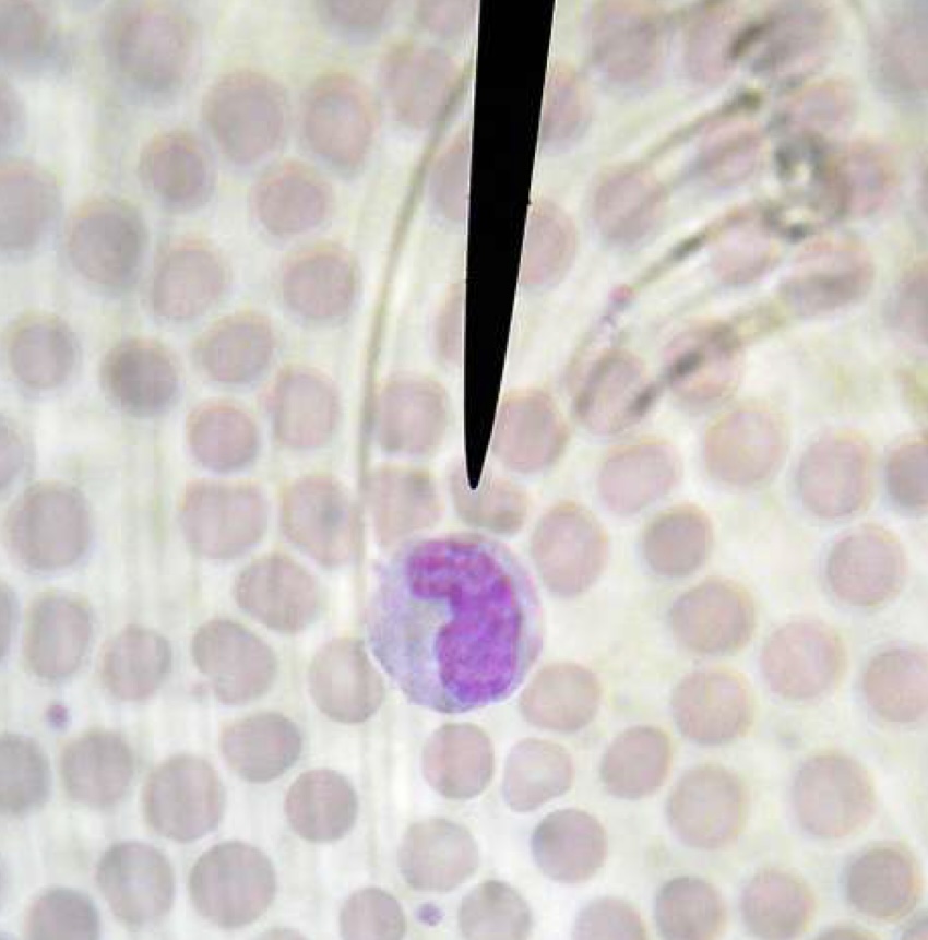 <p>What kind of blood cell is this?</p>