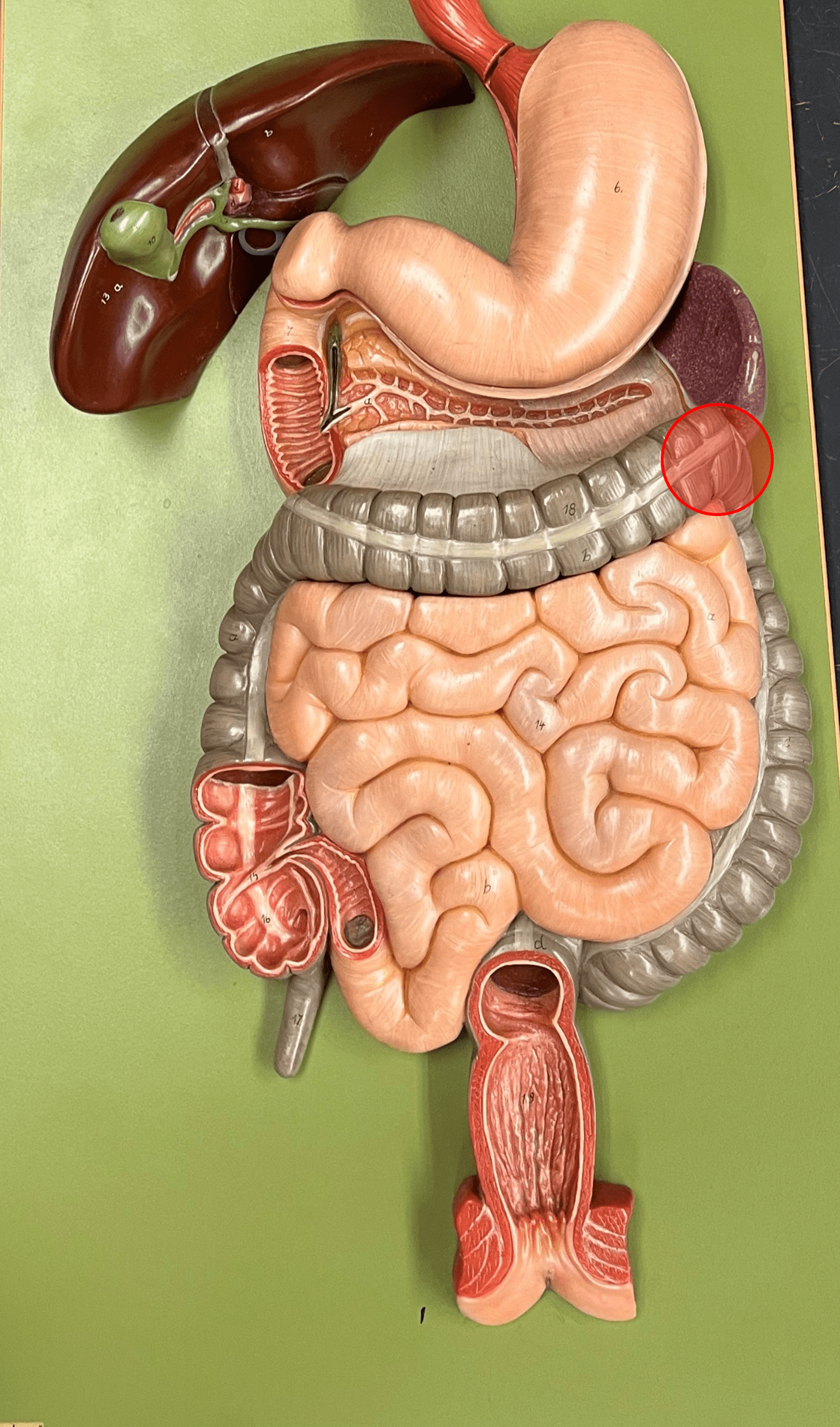 • The 90° turn of the transverse colon into the descending colon.

• Occurs near the spleen.

• Also known as the splenic flexure.