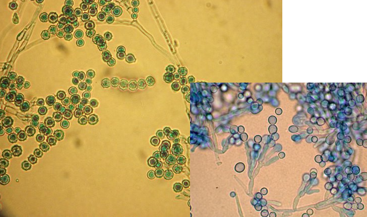 <p>infn: nails, tissue, lung, pts w BM transplant, chemotherapy</p><p></p><p>khaki color</p><p>conidia are spiky/rough </p><p>phialide are thicker</p>