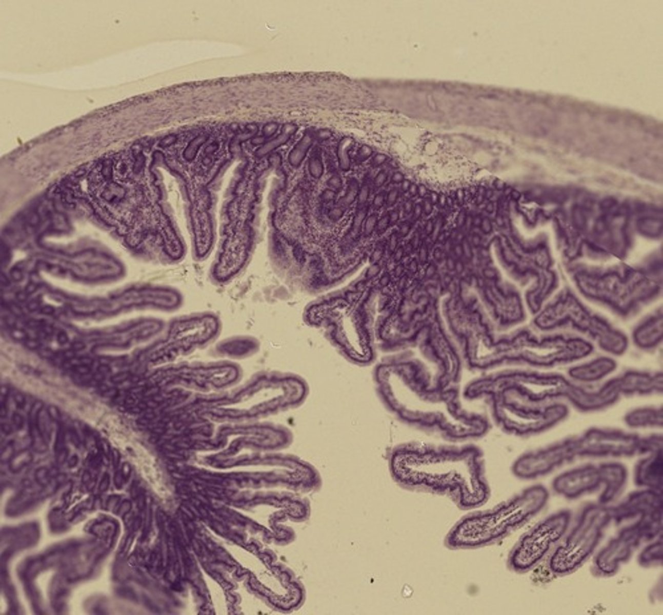 <p>Name the organ</p>