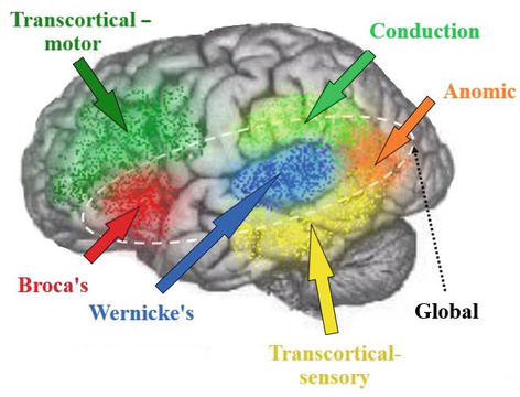 <p>angular and posterior middle temporal gyrus</p>