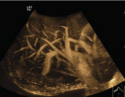 <p>What modality is used in this image?</p>