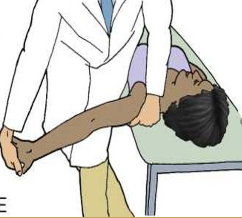 <p><strong>Purpose:&nbsp;</strong>To assess <strong>C5, C6, C7 </strong>and the <strong>median nerve</strong> as the source of the shoulder arm pain</p><p><strong>Steps: Client keep supine position, (RMT standing face to the cranial end)</strong>​</p><ol><li><p>Depress the shoulder and abduct the humerus to approximately 110 degrees. Extend the arm to 10 degrees below the coronal plane and to 60 degrees of external rotation. A stretching sensation is normally experienced across the anterior shoulder.​</p></li><li><p>Slowly extend the client's wrist, then the fingers. Tingling is normally experienced in the lateral three digits.​</p></li><li><p>Fully supinate the forearm, then slowly extend the elbow. A stretching sensation is normally experienced in the anterior elbow.​</p></li></ol><p><strong>Result: </strong>Reproducing the client's original shoulder or arm pain is a positive sign for C5 C6 C7 nerve roots or the median nerve as the source of the pain.​</p>