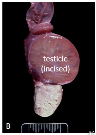 <p>where is the lesion?</p>