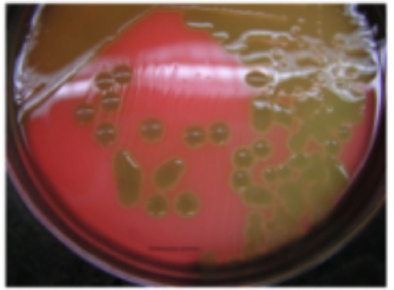 <p>Blood agar results</p>