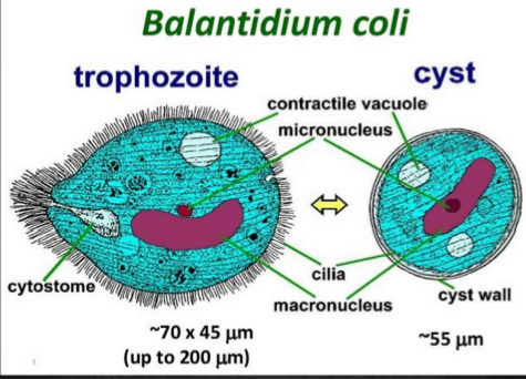 <ul><li><p>is morphologically more complex than E. histolytica</p></li><li><p>it has a primitive mouth called a <strong><u>cystome</u></strong>, a nucleus, food vacuoles, and a pair of contractile vacuoles.</p></li><li><p>The infective stage is the cyst and the pathogenic stage is the trophozoite, which invades the mucosal lining of the terminal ileum, cecum and colon.</p></li><li><p>It is the largest protozoan to infect humans</p><ul><li><p>the <strong>trophozoites</strong> exhibit a rotary, boring motility (through cilia) and contain two nuclei (a small dot-like micronucleus adjacent to a kidney bean-shaped macronucleus</p></li><li><p>The <strong>cyst </strong>also contains two nuclei although micronucleus may not be readily observable</p></li></ul></li><li><p>Parasite has a worldwide distribution. The most common and important<u> resevoir is the pig.</u></p></li><li><p><u>Monkeys may occasionally </u>act as resevoirs of the parasite.</p></li><li><p>The main source of infection is water contaminated by pig feces and the mode of transmission is through the <u>fecal-oral route.</u></p></li><li><p>Person-to-person transmission via food handlers has been implicated in outbreaks.</p></li><li><p>The cysts are found in contaminated water, which when ingested, undergoes excystation in the small intestines.</p></li><li><p>From there, the trophozoites travel to the large intestines where they produce ulcers similar to those seen in amoebiasis</p></li></ul><p></p>