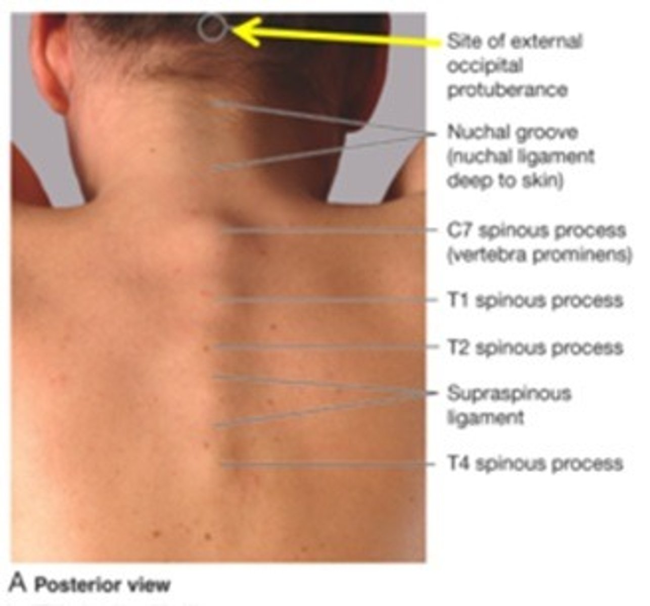 <p>-the most prominent bone you can feel when you bend your head forward, and it's often used as a landmark for counting vertebrae or ribs during assessments</p><p>-C7</p>