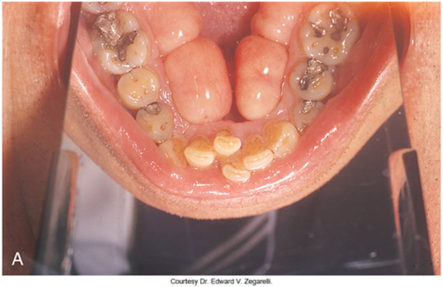 knowt flashcard image