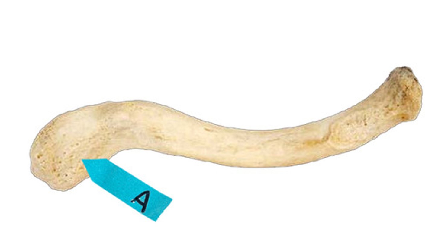 <p>Identify this bone marking.</p>
