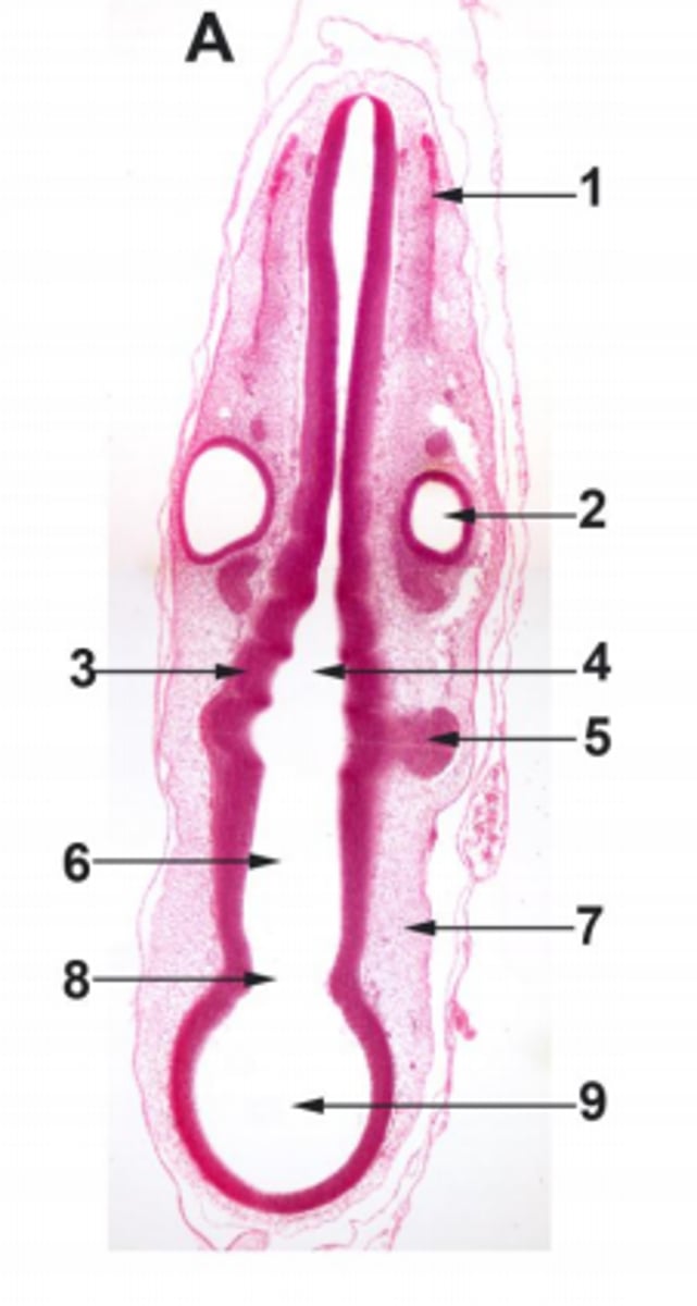 <p>#4 ectoderm</p>