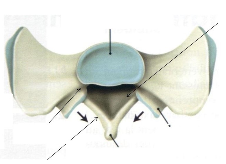 <ul><li><p>corps vertébral + promontoire (rebord antérieur) sur lequel se pose le disque intervertébral avec la 5ème et dernière vertèbre lombaire + déborde sur les côtés avec les ailes du sacrum</p></li><li><p>canal sacré → situé derrière pour les racines de la queue de cheval</p></li><li><p>pédicule + lame à l&apos;arrière du corps de S1</p></li><li><p>zygapophyses crâniales orientées en arrière et en dedans</p></li><li><p>PE de S1 ni volumineux ni bifide = crête sacrale médiale</p></li></ul>