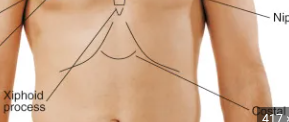 <p>right and left of xiphoid process</p><ul><li><p>normal= 90 degrees</p></li><li><p>angle increased when rib cage is chronically overinflated (ex.COPD)</p></li></ul><p></p>