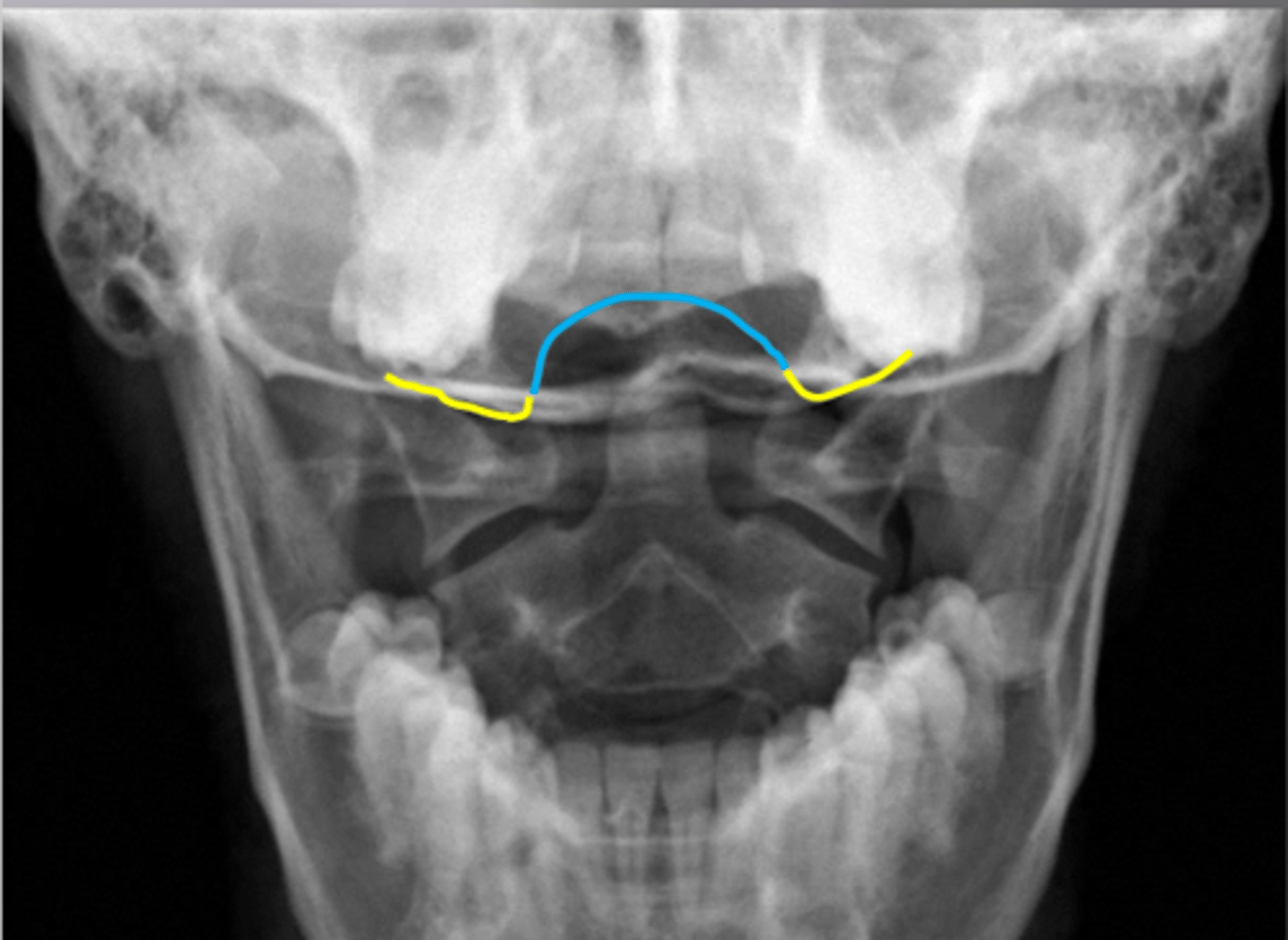 <p>What feature is shown here (yellow)?</p>