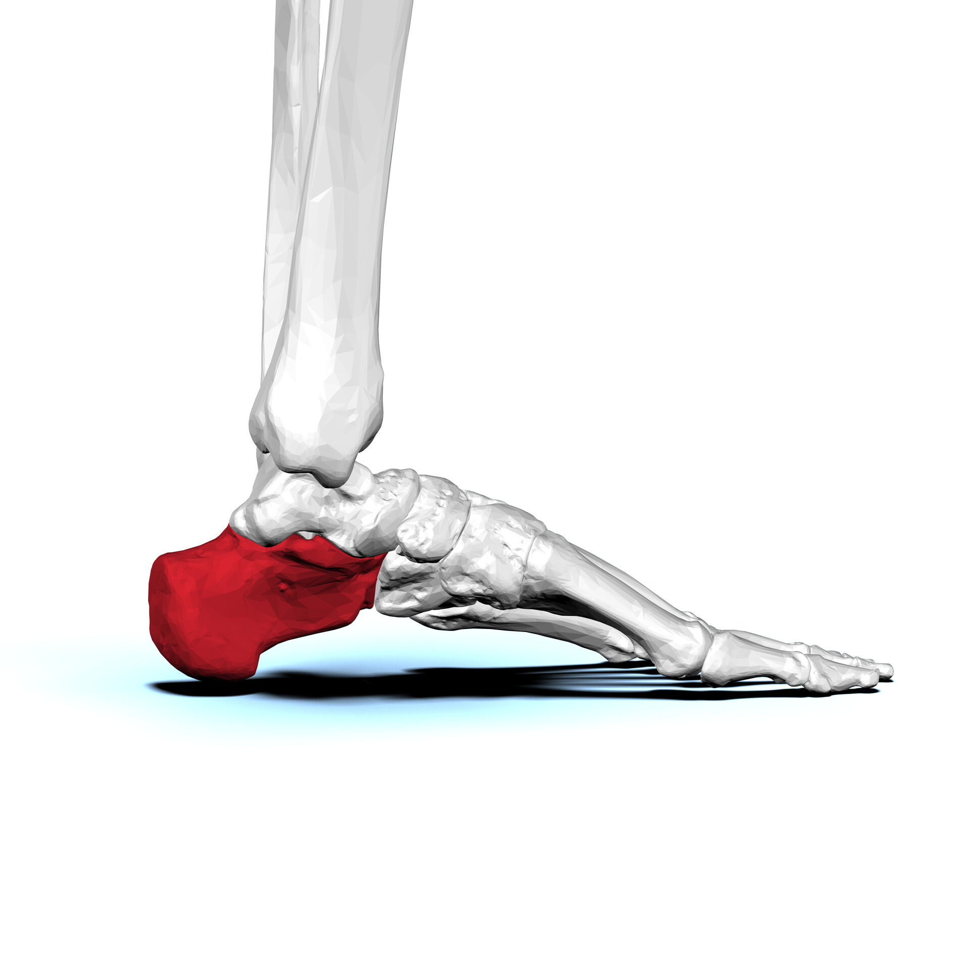 Name the bone. 