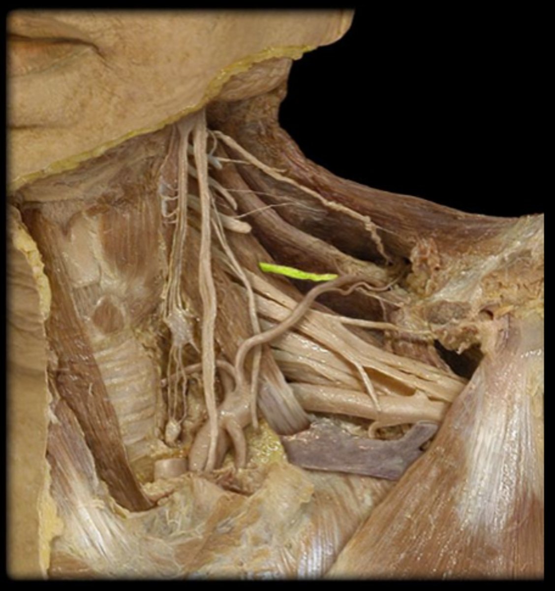 <p>What structure is shown?</p>