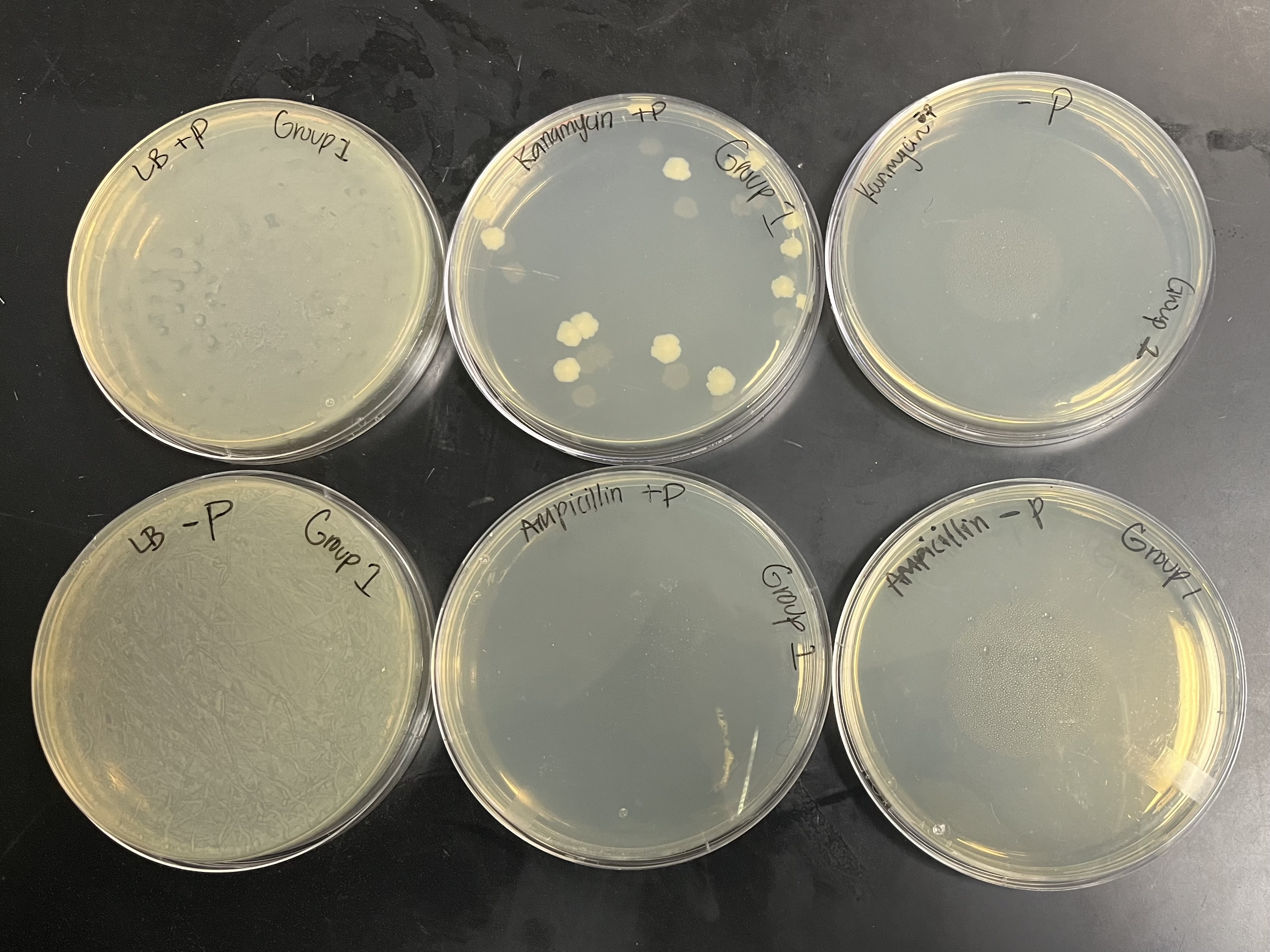 <p><strong>LB/amp+plasmid plate</strong></p><p>No lawn, no colonies</p><p><strong>LB/amp-plasmid plate</strong></p><p>No lawn, no colonies</p><p><strong>LB/kan+plasmid plate</strong></p><p>colonies</p><p><strong>LB/kan-plasmid plate</strong></p><p>No lawn, no colonies</p><p><strong>LB+plasmid</strong></p><p>bacterial lawn</p><p><strong>LB-plasmid</strong></p><p>bacterial lawn<br></p>