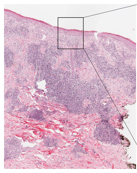 <p>is this abnormal or normal? localized or diffuse?</p>