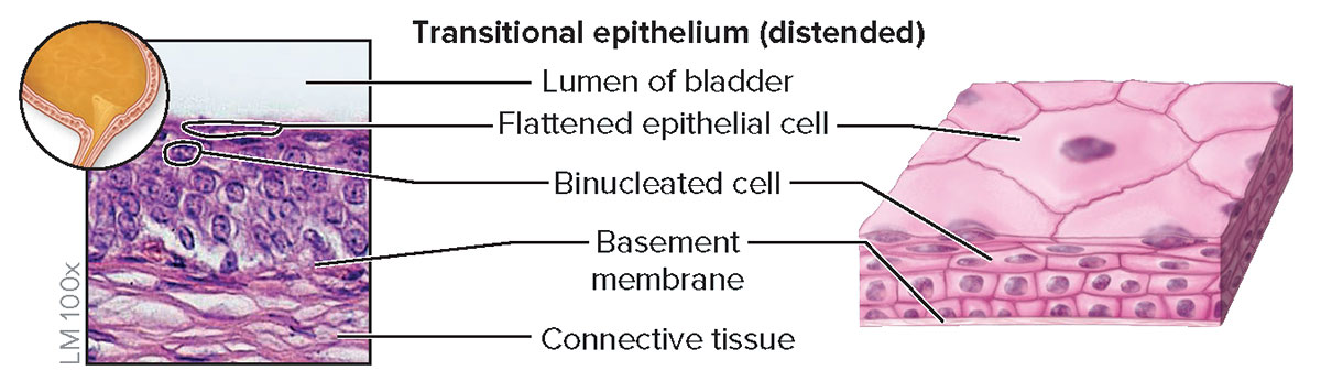 <p><strong>Structure</strong></p><p>Epithelial appearance varies, depending upon whether tissue is relaxed or distended (stretched); relaxed epithelium (<em>top</em>) has cuboidal or polyhedral cells and the apical cells are large and rounded, whereas distended epithelium (<em>bottom</em>) has flattened cells at the apical surface; some cells are binucleated</p><p><strong>Function</strong></p><p>Accomodates urine volume changes (by distending or relaxing) in the urinary bladder, ureters, and part of urethra</p><p><strong>Location</strong></p><p>Lining of urinary bladder, ureters, and part of urethra</p>
